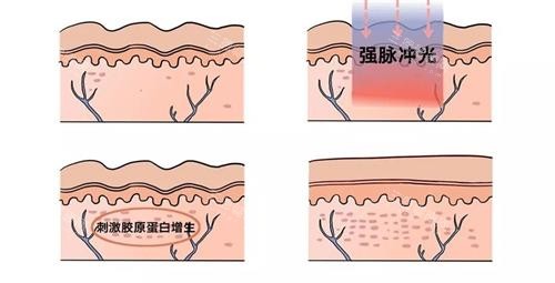选马鞍山朴源医美？术前评估免费+无强制消费，2025年新客享优惠！