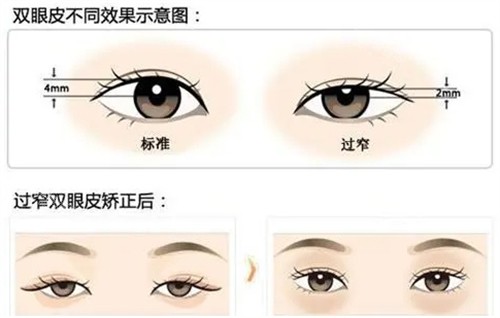 李炫直在韩国什么医院？高人气医美机构核心医师，擅长修复类手术！
