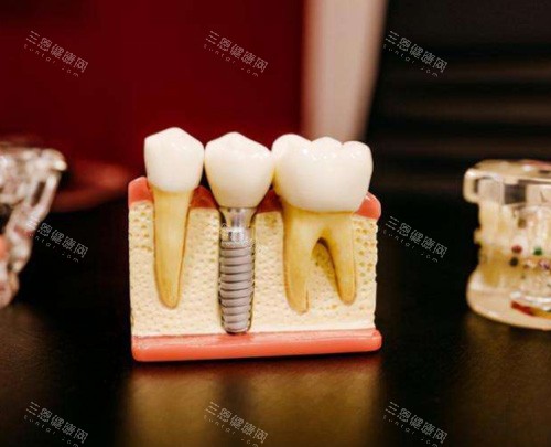 泸州大医大象口腔收费明细大揭秘，牙齿矫正几千元起，让你轻松拥有美牙！