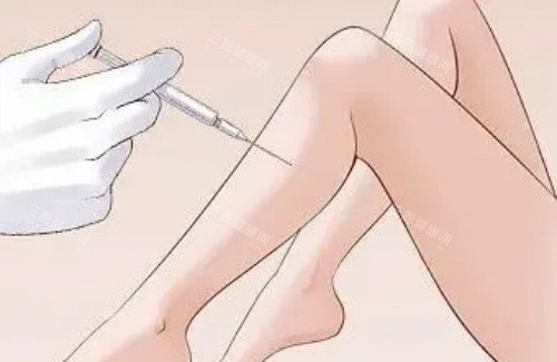 注射瘦腿示意图