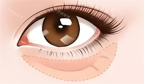 眼袋的位置卡通图