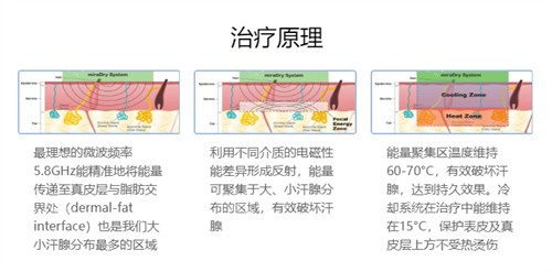 苏州乐桥腋臭专科医院是正规的！专有技术+签约治疗，术后无疤无异味