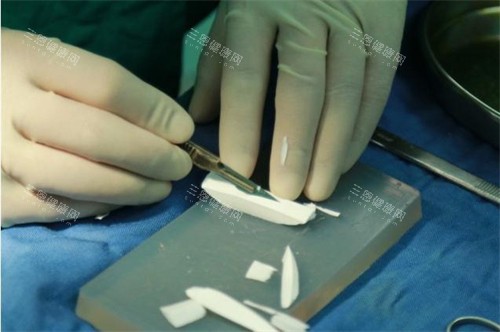 隆鼻手术正在雕刻的膨体