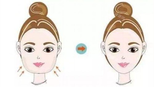 瘦脸**对比动画图 瘦脸**对比动画图