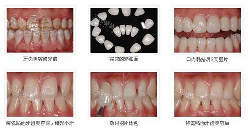 云阳看牙医院哪家强？老百姓真实反馈这几家牙科技术好，价格实惠还不踩雷！