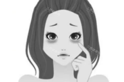 黑眼圈卡通图 黑眼圈卡通图
