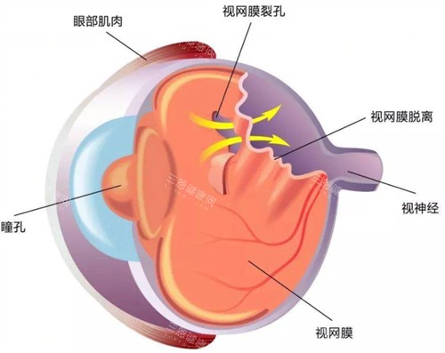 唐山开滦医院眼科怎么样？白内障、青光眼、眼底病等全方位眼病治疗!