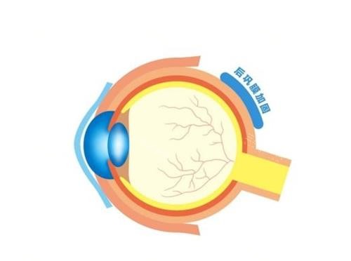 北京同仁眼科后巩膜加固术多少钱？基础术式2万起，段安丽主刀7.8万起，王乐今2.4万起