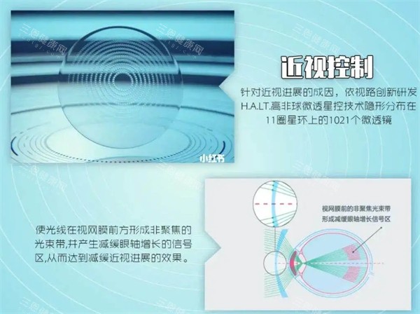 公示2025年义乌地区眼科项目收费标准：近视手术8800起/白内障5800起，从检查到治疗都有数！