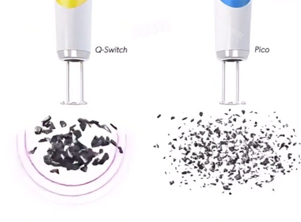 调Q激光和皮秒对比图