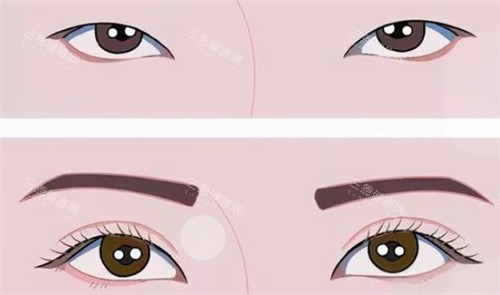 双眼皮前后对比 双眼皮前后对比