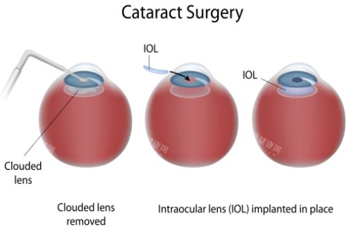 河北省眼科医院网上预约挂号攻略!官网预约/在线预约/电话预约等方式都能挂号！