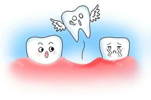 牙齿脱落示意图