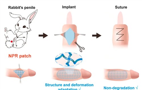 阴茎生物补片演示过程