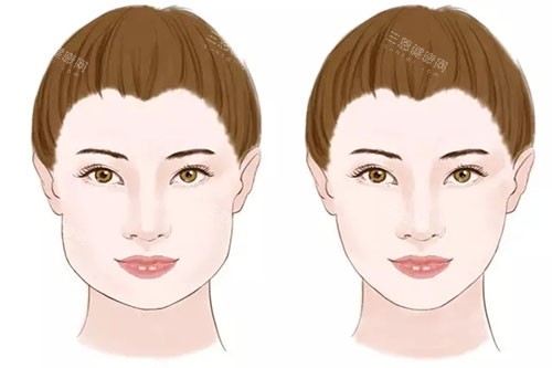 瘦脸卡通对比图