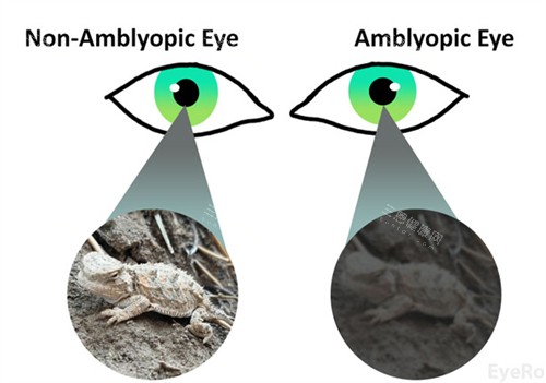 沈阳四院眼科当天去能看吗？