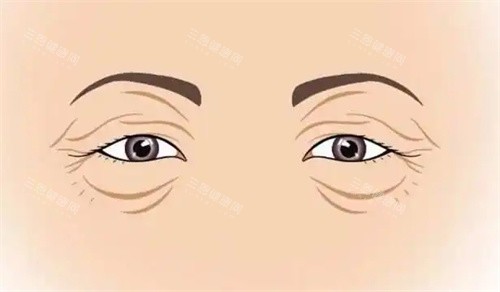 衰老的双眼皮 衰老的双眼皮