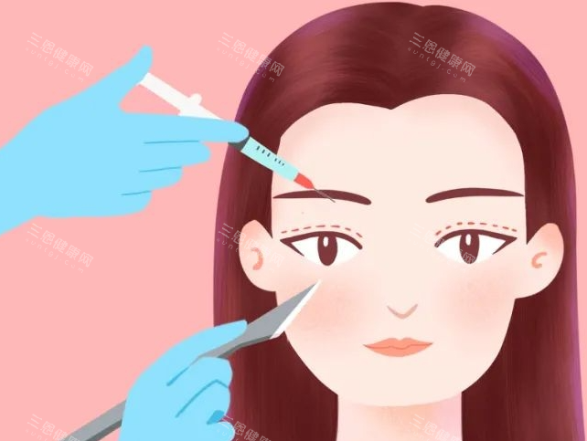 双眼皮画线展示图 双眼皮画线展示图