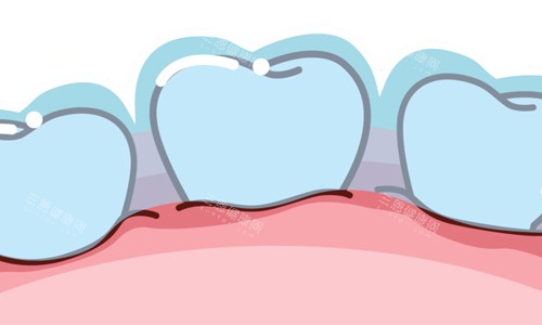 保护牙齿重要性