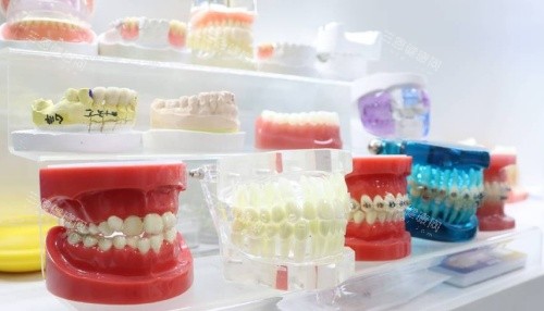 合肥佳德口腔假牙示意图 合肥佳德口腔假牙示意图