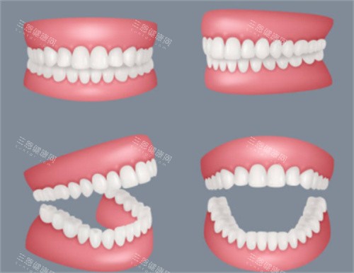 假牙各个角度 假牙各个角度