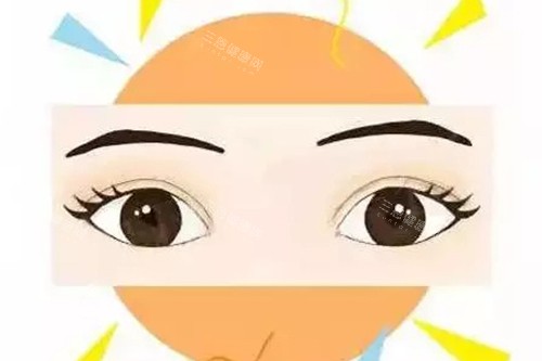 成功双眼皮示意图 成功双眼皮示意图