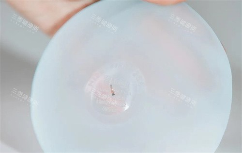 Motiva梦萦隆胸假体细节 Motiva梦萦隆胸假体细节