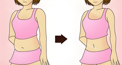 吸脂前与吸脂后对比素材图