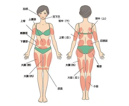 吸脂身体部位图片