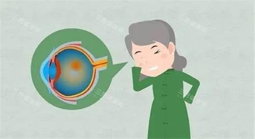 视网膜色素变性的示意图.