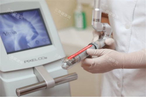 激光缩阴 激光缩阴