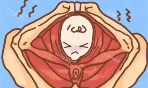 缩阴手术卡通图 缩阴手术卡通图