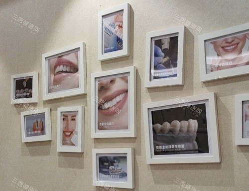 扬州贝恩口腔牙齿矫正展示区 扬州贝恩口腔牙齿矫正展示区