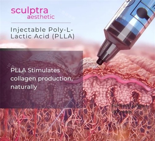 塑妍萃注射深度