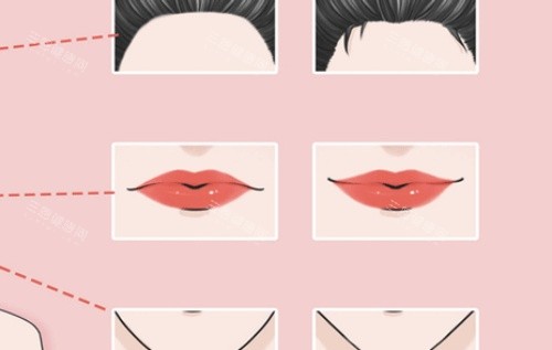 丰唇注射对比图