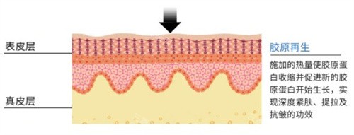 胶原蛋白再生 胶原蛋白再生