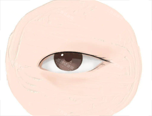 单眼皮形态 单眼皮形态