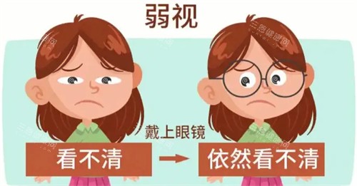 弱视眼睛视线