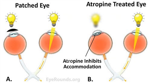 正常眼睛和弱视眼睛的区别 正常眼睛和弱视眼睛的区别
