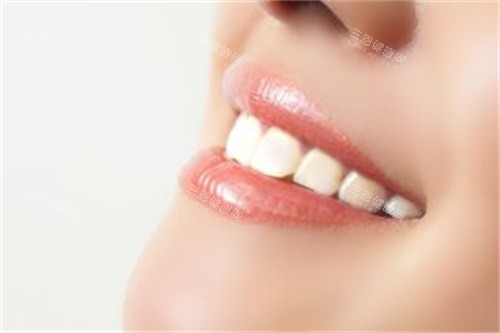 洁白整齐的牙齿宣传图 洁白整齐的牙齿宣传图