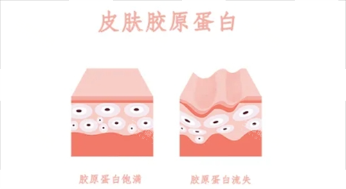 胶原蛋白在皮肤表面的动画示意图 胶原蛋白在皮肤表面的动画示意图