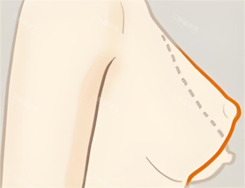 从狎鸥亭到清潭洞：一篇讲透AB整形医院的“出圈密码”——眼鼻+轮廓双头牌！