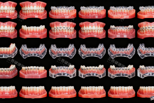 牙齿矫正步骤图一览
