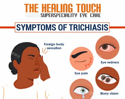 倒睫对眼睛的刺激 倒睫对眼睛的刺激