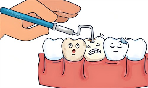 补牙手术项目动画