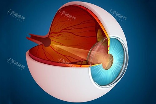 青光眼卡通图片展示 青光眼卡通图片展示