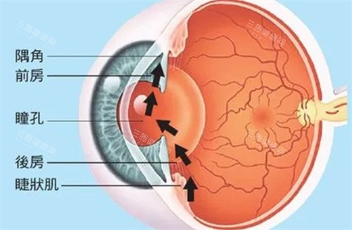青光眼眼压高的原因 青光眼眼压高的原因