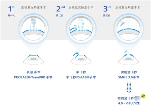 江西上饶爱尔眼科预约挂号超简单！线上平台快速约，提前对接需求，不耽误看眼