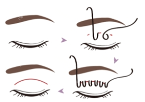 东莞港亚整形超正规！卫健委审批+诊疗规范，医美项目安心，变漂亮放心不踩坑