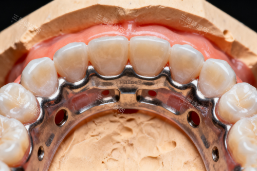 牙齿矫正之后的样子展示